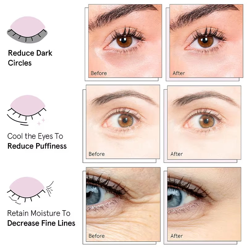 Wholesale Vegan Hyaluronic Acid Organic under Eye Masks for Dark Circles Puffy Eyes Bags & Wrinkles Gel Eye Patches